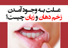 علت به وجود آمدن زخم دهان و زبان چیست؟
